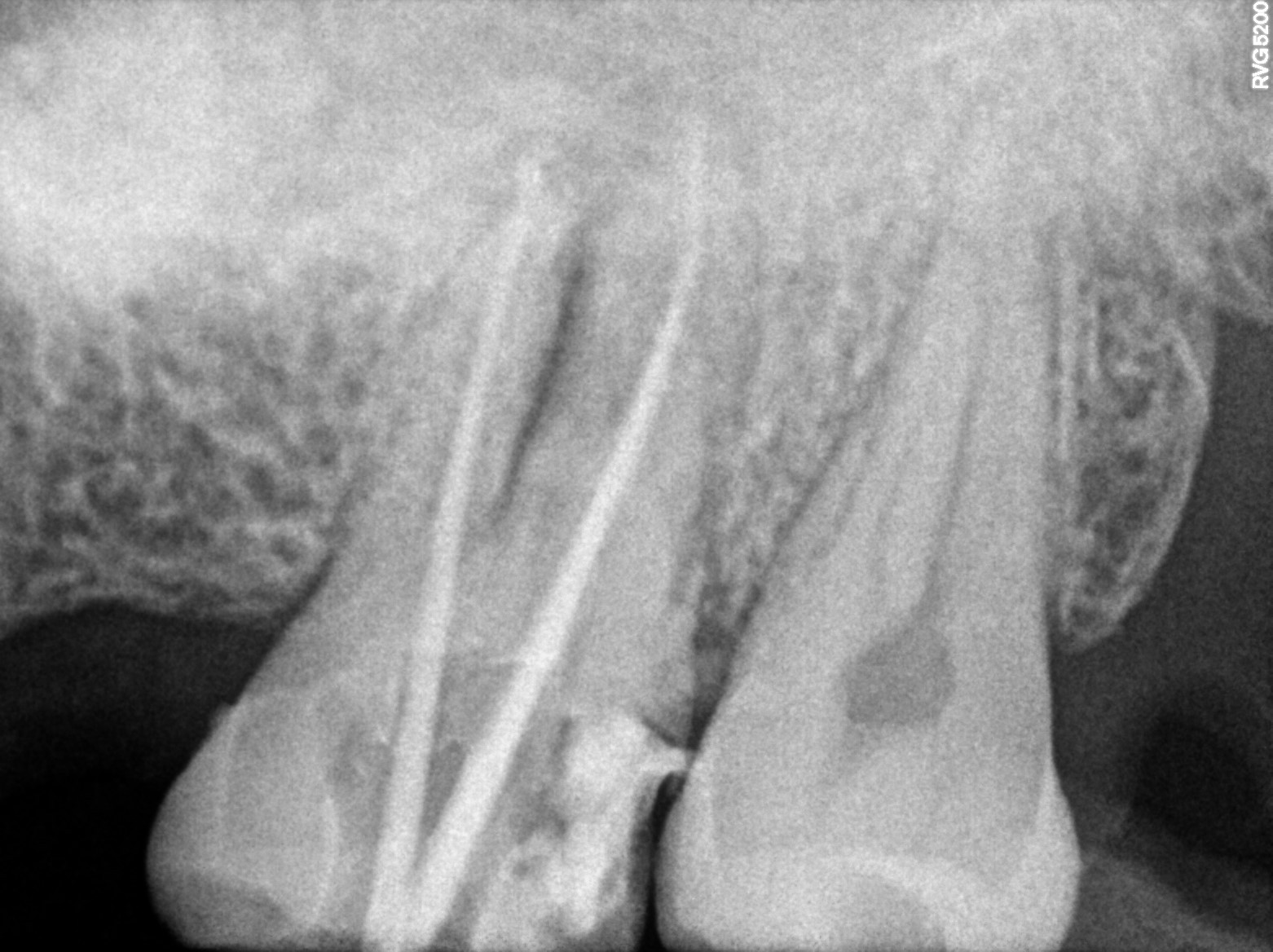 Dental X-ray